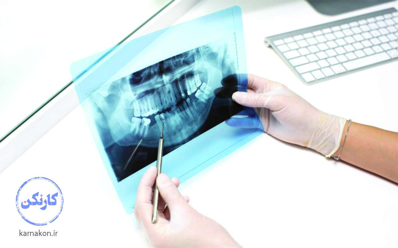 رشته های پرطرفدار کنکور تجربی - رادیولوژی دندان
